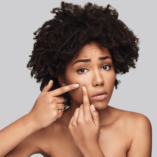 Everything that you need to know about acne